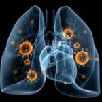 mesothelioma-pleural-disease