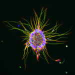 nerve-cells