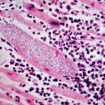 mycobacterium