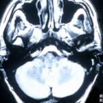 brain_scan