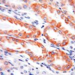 kidney_cells