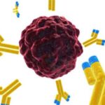 melanoma