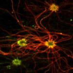 neuroni