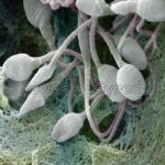 spermatozoi