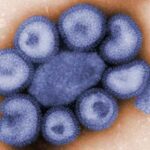 virus