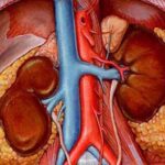 CKD