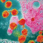 HIV_citochine