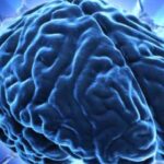 alzheimer