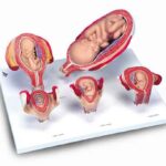 pregnancy