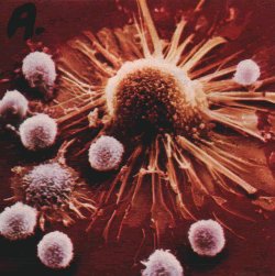 Linfociti vs cellula cancerosa