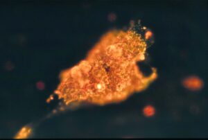 Cellula cancerosa illuminata con i nanorods d'oro