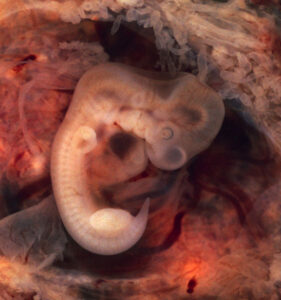 Embrione di 7 giorni