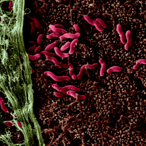 Una colonia di Helicobacter pylori sulla superficie intestinale