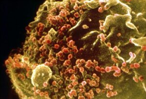 Un linfocita T infettato dal virus HIV