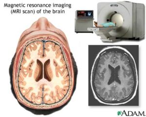 Magnetic resonance Imaging