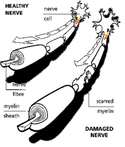 Neuroni, assoni e mielina
