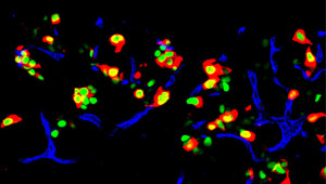 le cellule beta del pancreas di un topo