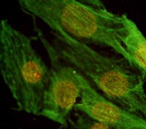 In verde i filamenti di actina