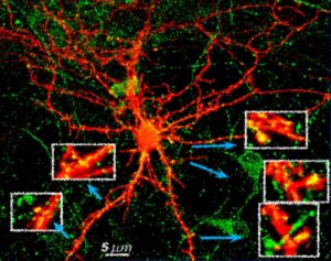 Marcatori proteici rossi e verdi fluorescenti (GFP) di un neurone ippocampale