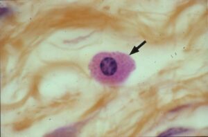 cellula mastocita