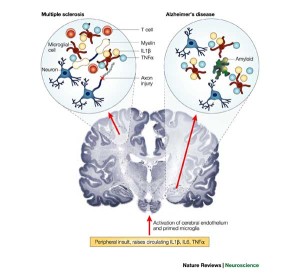 malattie neurodegenerative comuni