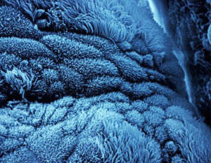 migliaia di minuscole ciglia (qui al microscopio) che tappezzano le pareti delle tube di Falloppio