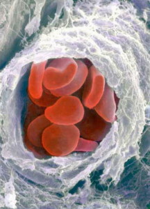 Globuli rossi fuori da un'arteria tagliata trasversalmente