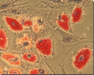 Coltura cellule staminali mesenchimali