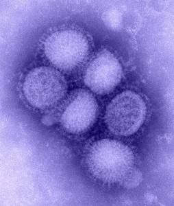 In fluorescenza blu, il virus della "A", H1N1