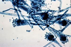 l'Aspergillus fumigatus, che scatena spesso asma e altre reazioni allergiche