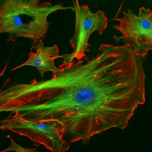 Cellula in fluorescenza: microtubuli in verde, actina (filamenti) in rosso.