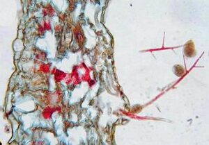 Phytophthora infestans