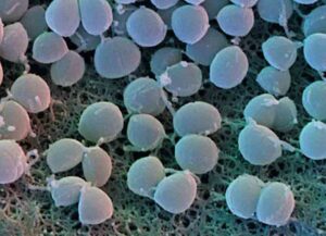 Staphilococcus aureus