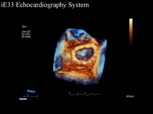 Immagine ecocardiografia 3D