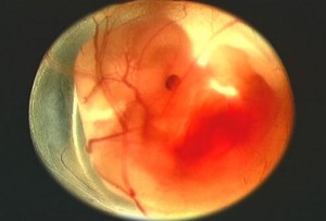 feto di otto settimane
