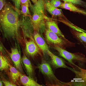 cellule staminali pluripotenti