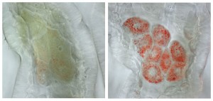 Epatociti della drosofila: destra cellule normali, sinistra: anomalo accumulo di grasso, in fluorescenza rossa