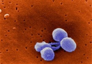 Streptococcus pneumoiae