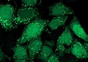 autofagosomi in fluorescenza verde