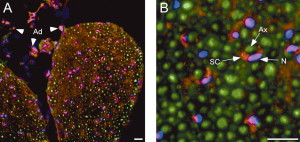 (A) Immunolabeling of SREBP-1 (red) and neurofilament (green) or DAPI staining (blue) shows that SREBP-1 protein is expressed in both Schwann cells and adipocytes (Ad) of adult mouse sciatic nerve. (B) SREBP-1 is expressed in and close to nuclei (N) of myelinating Schwann cells (SC) surrounding an axon (Ax)