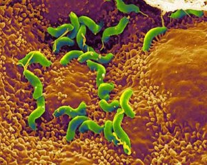 L'Helicobacter pylori sulle pareti intestinali