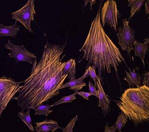 mesenchymal-stem-cells