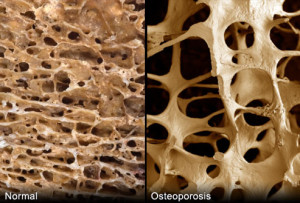 porous-bones1