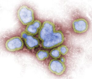 influenza_virus