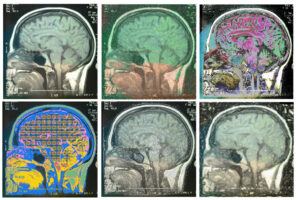 brain_scans