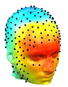 hd-EEG