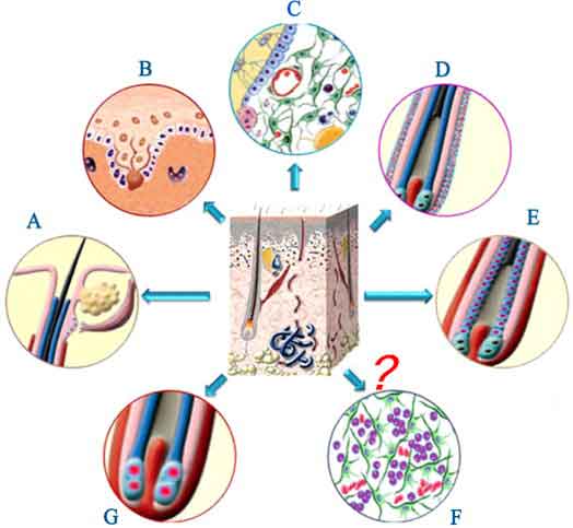 cellule staminali per ricrescita capelli